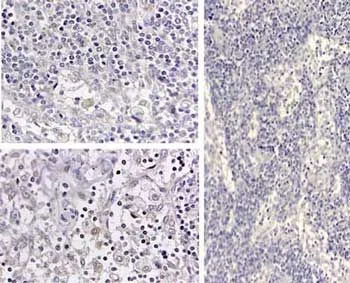 IHC-P analysis of medullary lymph node using IL1 beta antibody. Positive staining in the cytoplasm of circulating macrophages. Negative Control (far right) normal rabbit IgG.