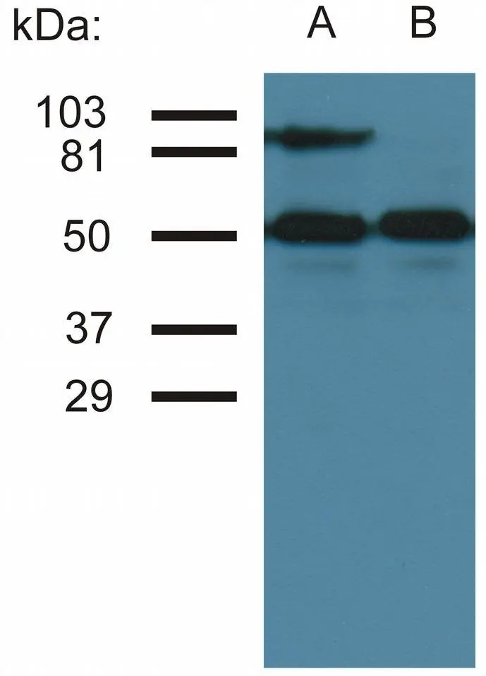 Western blottin analysis of CD54 expression in TNF-alpha activated (A) and nonactivated (B) HUVEC cells by GTX22213. Lower bands represent tubulin as a loading control.