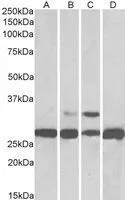 WB analysis of mouse (A), rat (B) and pig (C) liver lysate using GTX22220 PGAM1 / PGAM2 / PGAM4 antibody, C-term. Dilution : 0.03microg/ml Loading : 35microg protein in RIPA buffer WB analysis of mouse (A), rat (B) and pig (C) liver lysate using GTX22220 PGAM1 / PGAM2 / PGAM4 antibody, C-term. Dilution : 0.03microg/ml Loading : 35microg protein in RIPA buffer