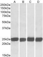 WB analysis of mouse (A+C) and rat (B+D) brain (A+B) and spleen (C+D) lysates using GTX22234 GRB2 antibody. Dilution : 0.05ug/ml Loading : 35ug protein in RIPA buffer
