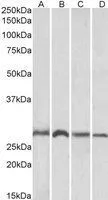 WB analysis of human liver lysate using GTX22237 SIAH1 antibody. Dilution : 1ug/ml Loading : 35ug protein in RIPA buffer