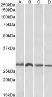 WB analysis of mouse (A, C) and rat (B, D) brain (A, B) and liver (C, D) lysates using GTX22237 SIAH1 antibody. Dilution : 1microg/ml Loading : 35microg protein in RIPA buffer