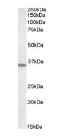 Western blot analysis of Annexin II in A431 lysate (RIPA buffer, 35microg total protein per lane) using GTX22242 at 0.5microg/ml