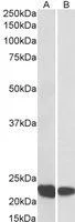 WB analysis of human thymus (A) and tonsil (B) lysate using GTX22244 RAC2 antibody. Dilution : 0.1microg/ml Loading : 35microg protein in RIPA buffer