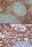 IHC-P analysis of human tonsil using GTX22244 RAC2 antibody. Antigen retrieval : Tris/EDTA buffer pH 9 Dilution : 0.3microg/ml A) Strong staining in the interfollicular area and mantle zone. B) Positive cells in the interfollicular area.