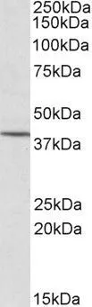 WB analysis of Molt-4 cell lysate using GTX22247 PSCDBP antibody,N-term. Dilution : 1ug/ml Loading : 35ug protein in RIPA buffer