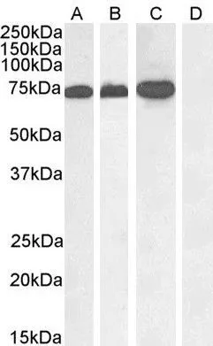 WB analysis of A431 nuclear (A), Jurkat (B), Jurkat nuclear (C) and negative control human pancreas (D) lysate using GTX22270 RACGAP1 antibody. Dilution : 1microg/ml Loading : 35microg protein in RIPA buffer