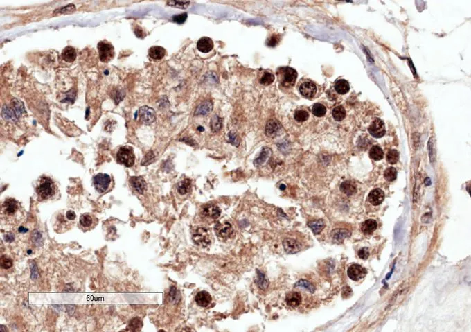 IHC-P analysis of human testis using GTX22270 RACGAP1 antibody. Antigen retrieval : Tris/EDTA buffer pH 9 Dilution : 4microg/ml