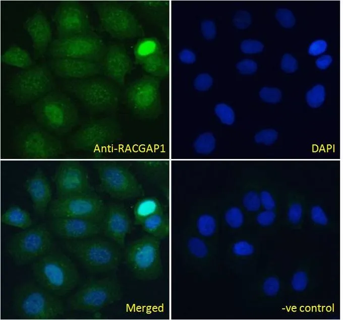 ICC/IF analysis of PFA fixed MCF7 cells using GTX22270 RACGAP1 antibody. Green : Primary antibody Blue : DAPI Negative control : Unimmunized goat IgG Permeabilization : 0.15% Triton Dilution : 10microg/ml