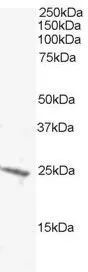 WB analysis of A431 lysate using GTX22273 BAK antibody. Dilution : 0.5microg/ml Loading : 30microg protein in RIPA buffer