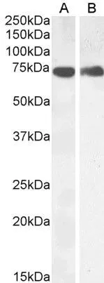 WB analysis of mouse kidney (A) and skeletal muscle (B) lysate using GTX22338 COX1 antibody. Dilution : 0.5microg/ml Loading : 35microg protein in RIPA buffer