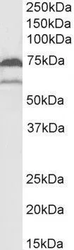 WB analysis of U937 lysate using GTX22338 COX1 antibody. Dilution : 2microg/ml Loading : 35microg protein in RIPA buffer