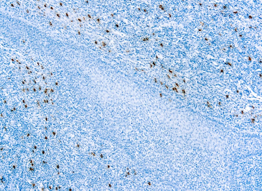 IHC-P analysis of human tonsil tissue using GTX22378 Mast cell tryptase antibody [AA1].