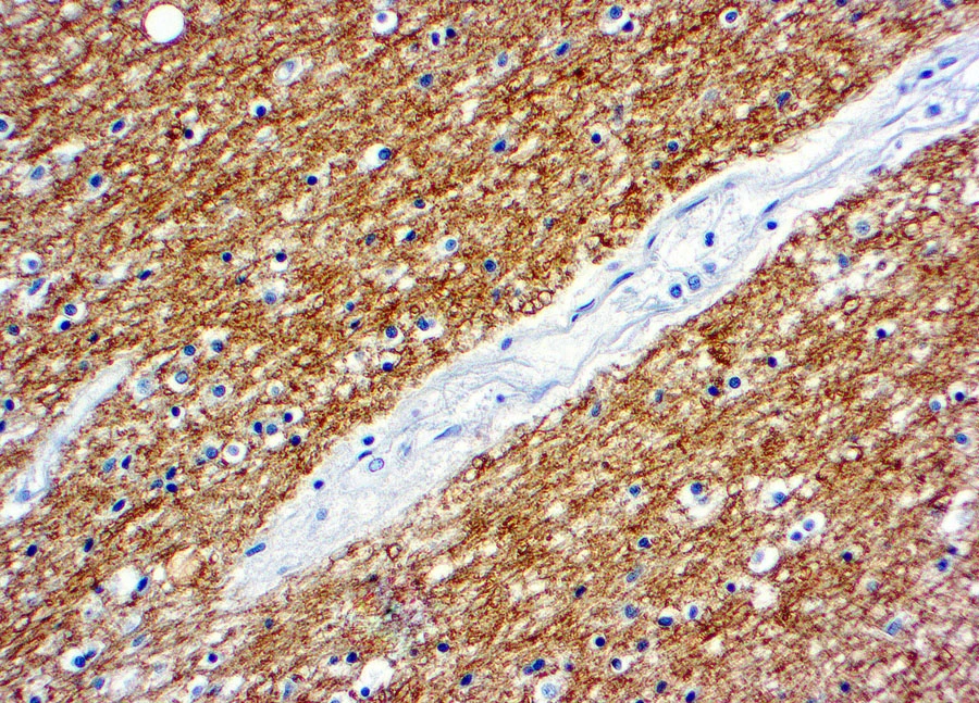 IHC-P analysis of human brain tissue using GTX22404 Myelin basic protein antibody.