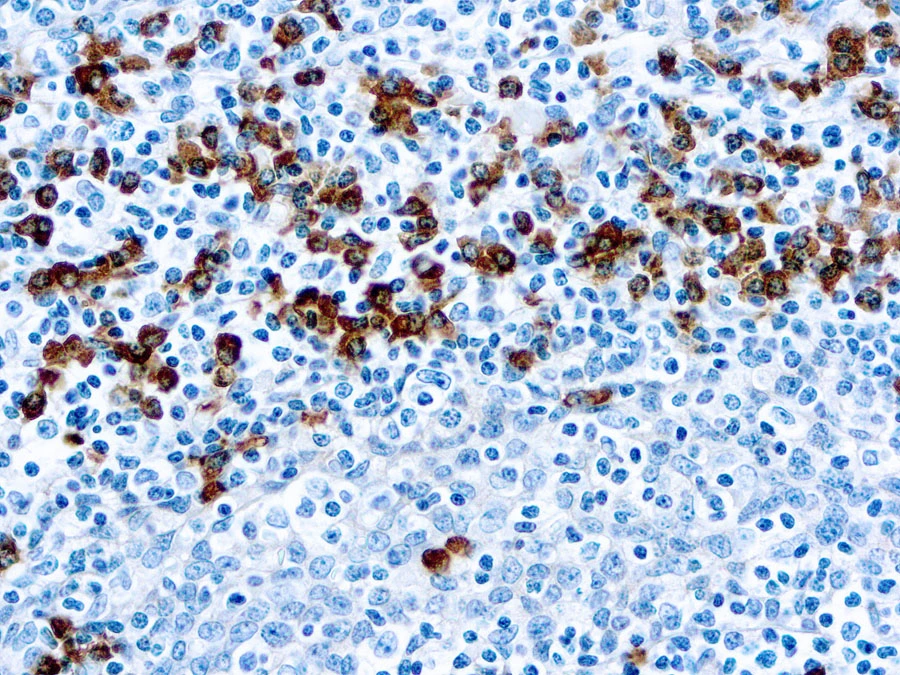 IHC-P analysis of human tonsil tissue using GTX22410 Human IgG antibody.