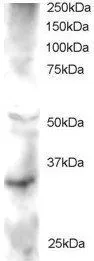 WB analysis of human heart lysate using GTX22470 FRAT2 antibody. Dilution : 2microg/ml Loading : 30microg protein in RIPA buffer