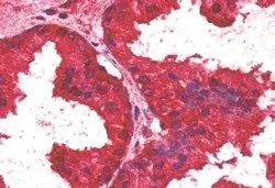 IHC-P analysis of human prostate using GTX22474 AIBZIP antibody. Antigen retrieval : citrate buffer pH 6 Dilution : 2.5microg/ml
