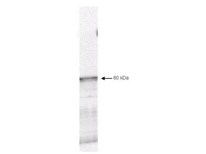 WB analysis of myc-tagged human PDK-1 protein using GTX22495 Pyruvate dehydrogenase kinase 1 / PDK1 antibody. Dilution : 1:750