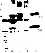 WB analysis of various sample lysates using GTX22506 p63 antibody. Lane 1 : Jurkat Lane 2 : Mouse lung Lane 3 : mouse thymus Lane 4 : mouse lung Lane 5 : mouse heart