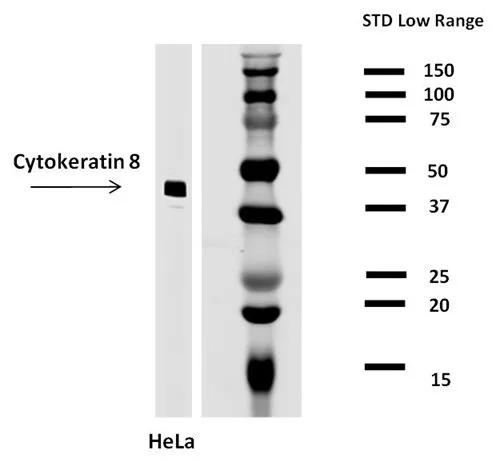 WB analysis of HeLa cell lysate  using GTX22530 Cytokeratin 8 antibody [C-43].
