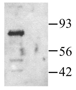 Human PAK1 detected by Western blot in transfected HEK293 cells (left lane)