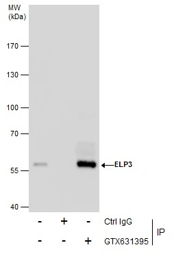 EasyBlot anti-Mouse IgG Kit (Optimized for Prot A/G) (GTX225857-01) was used as a secondary reagent for immunoprecipitation analysis. HepG2 lysates were immunoprecipitated using 5 ug of normal rabbit IgG or ELP3 antibody [GT11811] (GTX631395).