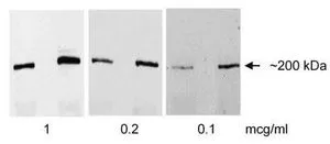 WB analysis of rat liver tissue (50ug,150ug) using GTX22609 EIF4G1 antibody. Diluition : 1,0.2,0.1ug/ml
