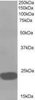 WB analysis of A549 lysate using GTX22634 RKIP antibody, C-term. Dilution : 1microg/ml Loading : 35microg protein in RIPA buffer WB analysis of A549 lysate using GTX22634 RKIP antibody, C-term. Dilution : 1microg/ml Loading : 35microg protein in RIPA buffer