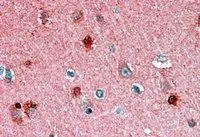 IHC-P analysis of human cortex using GTX22634 RKIP antibody, C-term. Antigen retrieval : citrate buffer pH 6 Dilution : 1.5microg/ml