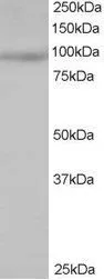 WB analysis of Jurkat lysate using GTX22646 MAP4K1 antibody, N-term. Dilution : 0.5microg/ml Loading : 35microg protein in RIPA buffer