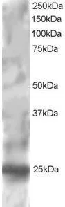 WB analysis of HepG2 lysate using GTX22715 RGS1 antibody. Dilution : 1microg/ml Loading : 30microg protein in RIPA buffer