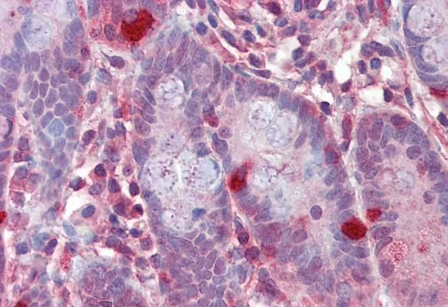 IHC-P analysis of human small intestine using GTX22715 RGS1 antibody. Antigen retrieval : citrate buffer pH 6 Dilution : 2.5microg/ml