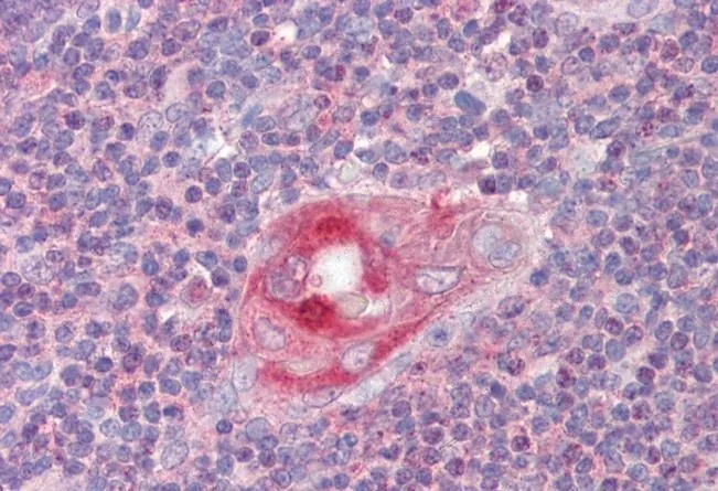IHC-P analysis of human thymus using GTX22715 RGS1 antibody. Antigen retrieval : citrate buffer pH 6 Dilution : 2.5microg/ml