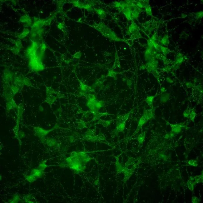 ICC/IF analysis of U251 cells using GTX22723 PSD95 antibody [6G6-1C9]. Cells were probed without (right) or with(left) an antibody. Green : Primary antibody Blue : Nuclei Fixation : formaldehyde Dilution : 1:200 overnight at 4?