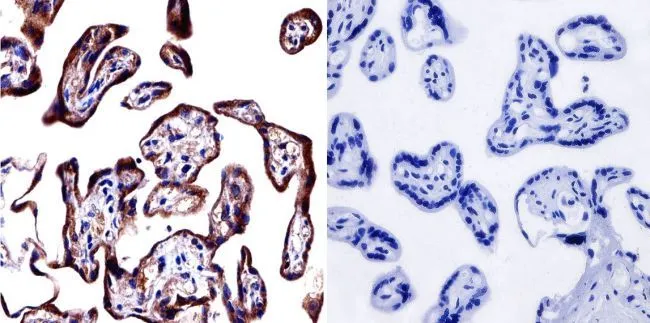 IHC-P analysis of human placenta tissue using GTX22729 Cytohesin 1 + Cytohesin 2 antibody [6G11]. Left : Primary antibody Right : Negative control without primary antibody Antigen retrieval : heat induced antigen retrieval was performed using 10mM sodium citrate (pH6.0) buffer, microwaved for 8-15 minutes Dilution : 1:500