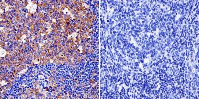 IHC-P analysis of human tonsil tissue using GTX22729 Cytohesin 1 + Cytohesin 2 antibody [6G11]. Left : Primary antibody Right : Negative control without primary antibody Antigen retrieval : heat induced antigen retrieval was performed using 10mM sodium citrate (pH6.0) buffer, microwaved for 8-15 minutes Dilution : 1:200