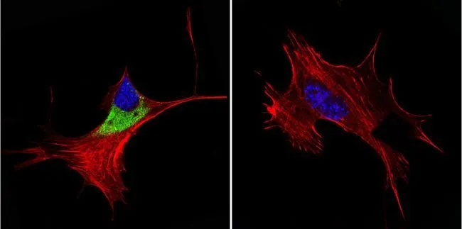 ICC/IF analysis of NIH-3T3 cells using GTX22729 Cytohesin 1 + Cytohesin 2 antibody [6G11]. Cells were probed without (right) or with(left) an antibody. Green : Primary antibody Blue : Nuclei Red : Actin Fixation : formaldehyde Dilution : 1:100 overnight at 4 oC