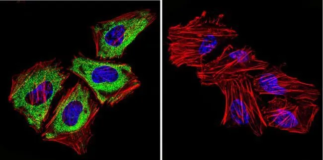 ICC/IF analysis of HeLa cells using GTX22729 Cytohesin 1 + Cytohesin 2 antibody [6G11]. Cells were probed without (right) or with(left) an antibody. Green : Primary antibody Blue : Nuclei Red : Actin Fixation : formaldehyde Dilution : 1:100 overnight at 4 oC