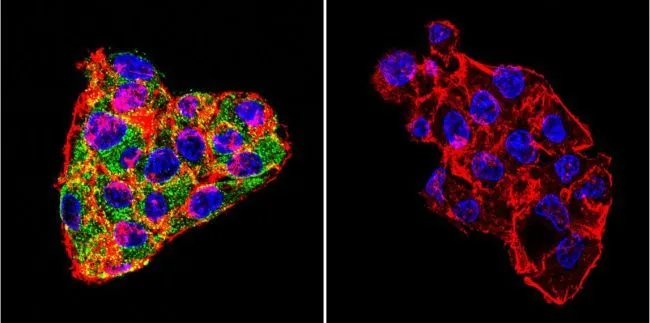 ICC/IF analysis of HepG2 cells using GTX22729 Cytohesin 1 + Cytohesin 2 antibody [6G11]. Cells were probed without (right) or with(left) an antibody. Green : Primary antibody Blue : Nuclei Red : Actin Fixation : formaldehyde Dilution : 1:100 overnight at 4 oC