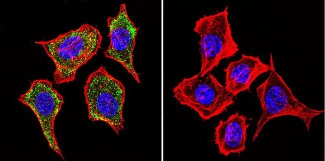 ICC/IF analysis of HeLa cells using GTX22733 IGF2R antibody [2G11]. Cells were probed without (right) or with(left) an antibody. Green : Primary antibody Blue : Nuclei Red : Actin Fixation : formaldehyde Dilution : 1:20 overnight at 4oC