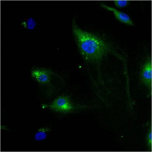 ICC/IF analysis of HeLa cells using GTX22733 IGF2R antibody [2G11]. Cells were probed without (right) or with(left) an antibody. Green : Primary antibody Blue : Nuclei Red : Actin Fixation : formaldehyde Dilution : 1:20 overnight at 4C