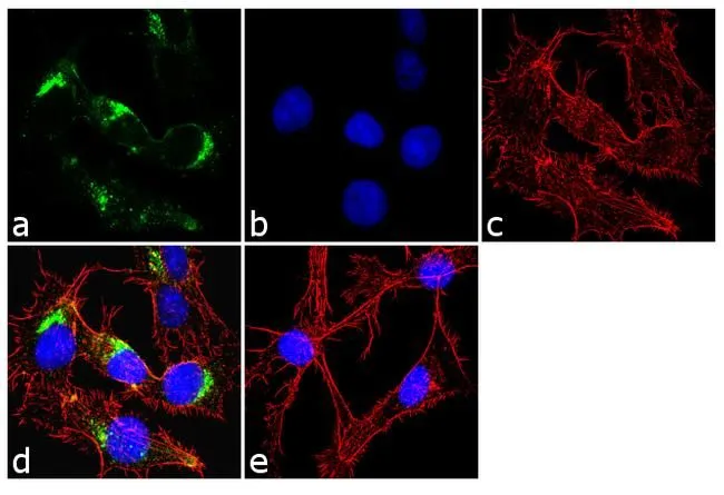 ICC/IF analysis of HepG2 cells using GTX22733 IGF2R antibody [2G11]. Panel e is a no primary antibody control. Green : Primary antibody Blue : Nuclei Red : Actin Fixation : 4% paraformaldehyde Permeabilization : 0.1% Triton X-100 for 10 minute Dilution : 2 microg/ml in 0.1% BSA incubated for 3 hours at room temperature