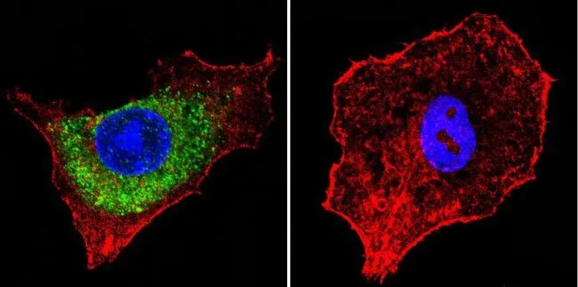 ICC/IF analysis of HepG2 cells using GTX22733 IGF2R antibody [2G11]. Cells were probed without (right) or with(left) an antibody. Green : Primary antibody Blue : Nuclei Red : Actin Fixation : formaldehyde Dilution : 1:20 overnight at 4oC