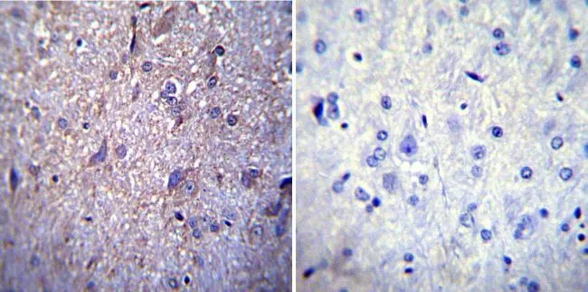 IHC-P analysis of rat brain tissue using GTX22734 Nucleoporin p62 antibody [RL1]. Left : Primary antibody Right : Negative control without primary antibody Antigen retrieval : heat induced antigen retrieval was performed using 10mM sodium citrate (pH6.0) buffer, microwaved for 8-15 minutes Dilution : 1:200