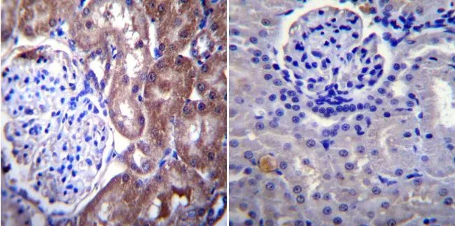 IHC-P analysis of rat kidney tissue using GTX22734 Nucleoporin p62 antibody [RL1]. Left : Primary antibody Right : Negative control without primary antibody Antigen retrieval : heat induced antigen retrieval was performed using 10mM sodium citrate (pH6.0) buffer, microwaved for 8-15 minutes Dilution : 1:200
