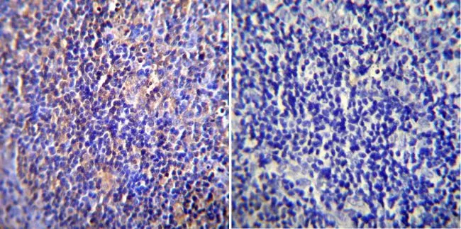 IHC-P analysis of rat lymph node tissue using GTX22734 Nucleoporin p62 antibody [RL1]. Left : Primary antibody Right : Negative control without primary antibody Antigen retrieval : heat induced antigen retrieval was performed using 10mM sodium citrate (pH6.0) buffer, microwaved for 8-15 minutes Dilution : 1:200
