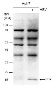 Non-transfected (�) and transfected (+) Huh7 whole cell extracts (25 ug) were separated by 12% SDS-PAGE,and the membrane was blotted with Hepatitis B Virus X Protein antibody [X36C] (GTX22741) diluted at 1:1000.