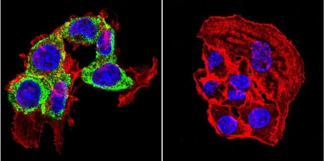 ICC/IF analysis of HepG2 cells using GTX22743 Thyroid Hormone Receptor antibody [C3]. Cells were probed without (right) or with(left) an antibody. Green : Primary antibody Blue : Nuclei Red : Actin Fixation : formaldehyde Dilution : 1:20 overnight at 4C