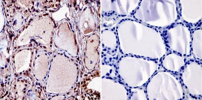IHC-P analysis of human thyroid tissue using GTX22744 Thyroid Hormone Receptor beta antibody [J52].