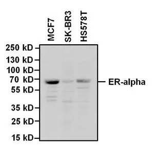 WB analysis of full-length human ER alpha recombinant protein and ER beta protein using GTX22746 Estrogen Receptor alpha antibody [33] at 4 ug/ml (left panel) or GTX25786 Estrogen Receptor beta antibody at 1:2000 (right panel).